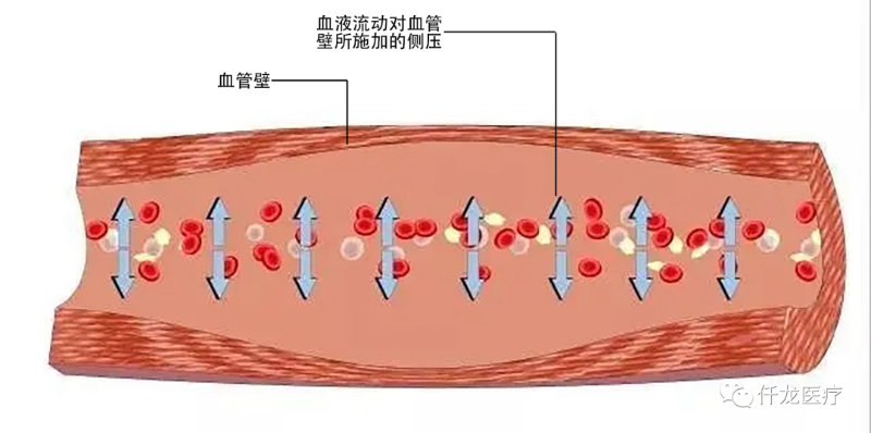 高血壓的形成